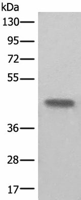 Western blot analysis of Human kidney tissue lysate using BHMT2 Polyclonal Antibody at dilution of 1:450