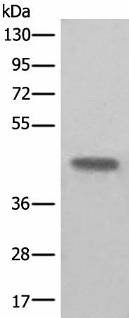 Western blot analysis of Human kidney tissue lysate using BHMT2 Polyclonal Antibody at dilution of 1:450