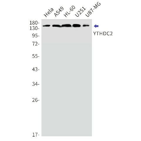 Western blot detection of YTHDC2 in Hela,A549,HL-60,U251,U87-MG cell lysates using YTHDC2 Rabbit mAb(1:1000 diluted).Predicted band size:160kDa.Observed band size:160kDa.