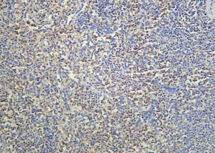 Anti-Human cIAP2 Antibody [B938] - ABMIUM