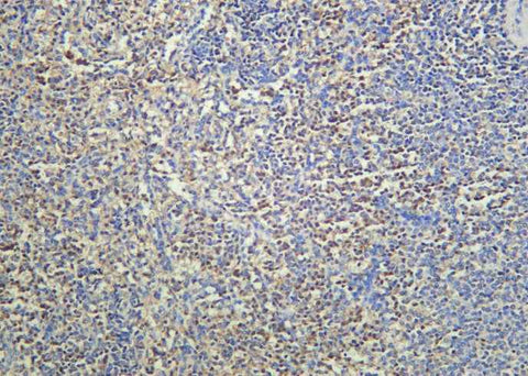 Anti-Human cIAP2 Antibody [B938] - ABMIUM