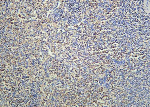 Anti-Human cIAP2 Antibody [B938] - ABMIUM