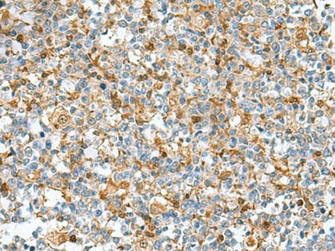 Immunohistochemistry of paraffin-embedded Human tonsil tissue using DNPH1 Polyclonal Antibody at dilution of 1:55(×200)