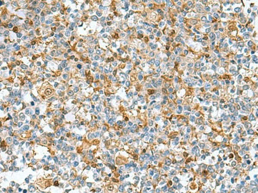 Immunohistochemistry of paraffin-embedded Human tonsil tissue using DNPH1 Polyclonal Antibody at dilution of 1:55(×200)