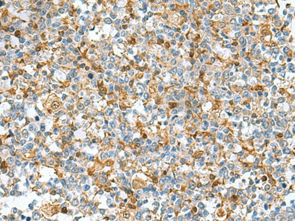 Immunohistochemistry of paraffin-embedded Human tonsil tissue using DNPH1 Polyclonal Antibody at dilution of 1:55(×200)
