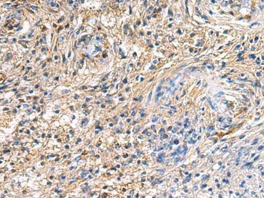 Anti-Human/Mouse/Rat SAV1 Antibody