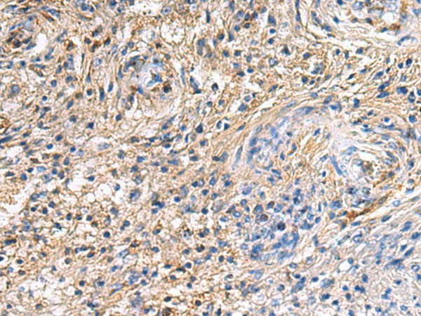 Immunohistochemistry of paraffin-embedded Human brain tissue using SAV1 Polyclonal Antibody at dilution of 1:90(×200)