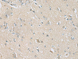 Immunohistochemistry of paraffin-embedded Human brain tissue using TSTA3 Polyclonal Antibody at dilution of 1:80(×200)