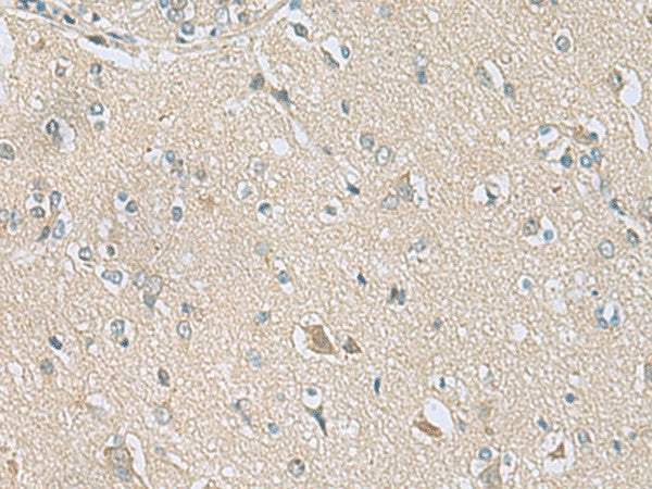 Immunohistochemistry of paraffin-embedded Human brain tissue using TSTA3 Polyclonal Antibody at dilution of 1:80(×200)