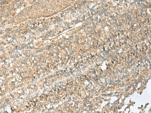 Immunohistochemistry of paraffin-embedded Human tonsil tissue using NID2 Polyclonal Antibody at dilution of 1:70(×200)
