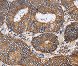 Anti-Human/Mouse/Rat PDGFC Antibody - ABMIUM