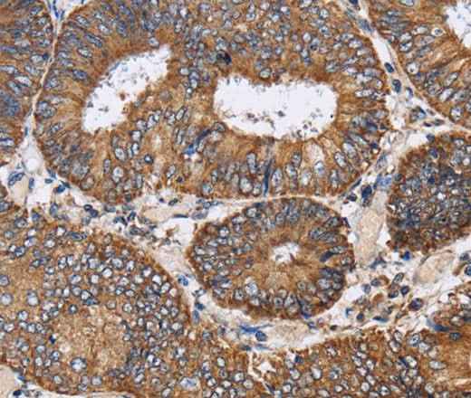 Anti-Human/Mouse/Rat PDGFC Antibody