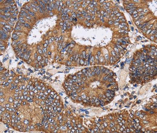 Anti-Human/Mouse/Rat PDGFC Antibody - ABMIUM