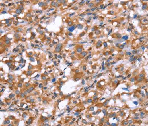 Anti-Human/Mouse GPC6 Antibody