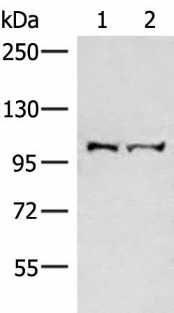 Western blot analysis of Mouse brain tissue and Jurkat cell lysates using EFTUD2 Polyclonal Antibody at dilution of 1:550