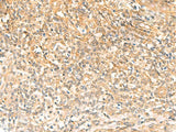 Immunohistochemistry of paraffin-embedded Human tonsil tissue using UBD Polyclonal Antibody at dilution of 1:50(×200)