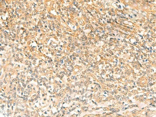 Immunohistochemistry of paraffin-embedded Human tonsil tissue using UBD Polyclonal Antibody at dilution of 1:50(×200)