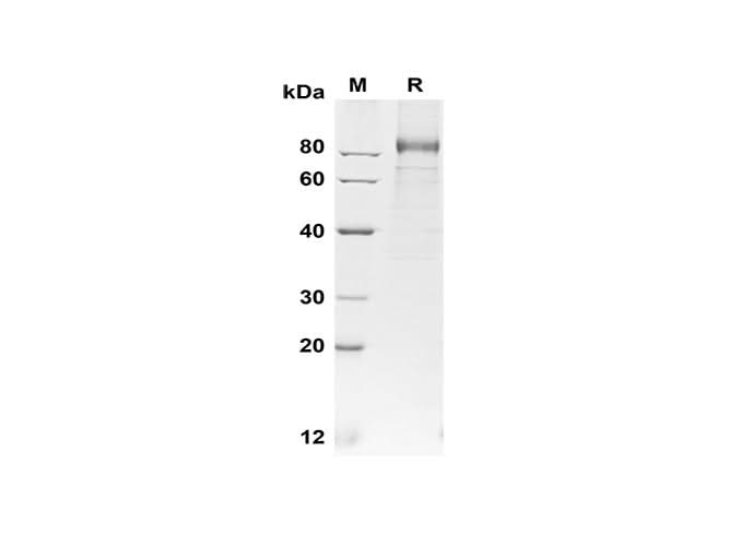 SDS-PAGE analysis of Human G-CSF R/CD114 proteins, 2 μg/lane of Recombinant Human G-CSF R/CD114 proteins was resolved with SDS-PAGE under reducing conditions, showing bands at 85-90 kDa.