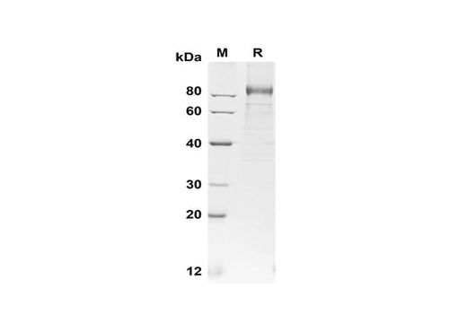 SDS-PAGE analysis of Human G-CSF R/CD114 proteins, 2 μg/lane of Recombinant Human G-CSF R/CD114 proteins was resolved with SDS-PAGE under reducing conditions, showing bands at 85-90 kDa.