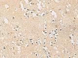 Immunohistochemistry of paraffin-embedded Human brain tissue using PDE4DIP Polyclonal Antibody at dilution of 1:45(×200)