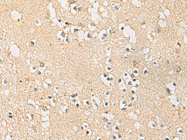 Immunohistochemistry of paraffin-embedded Human brain tissue using PDE4DIP Polyclonal Antibody at dilution of 1:45(×200)