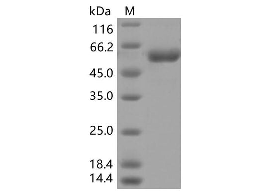 Recombinant SARS-CoV-2 Spike RBD (K417T)(rFc Tag) - ABMIUM