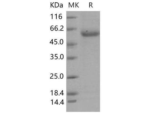 Recombinant Mouse ENPP7/NPP-7 Protein (His Tag) - ABMIUM