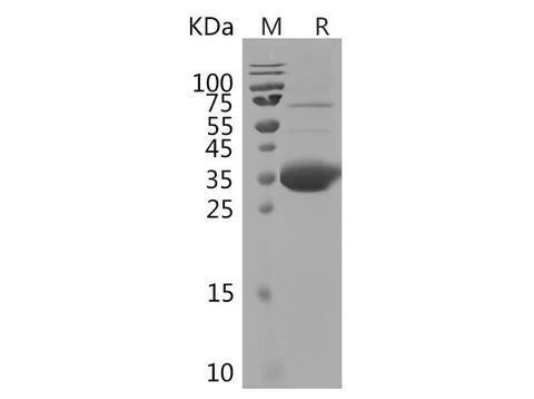 SDS-PAGE analysis of Rabbit IL21 proteins, 2 μg/lane of Recombinant Rabbit IL21 proteins was resolved with SDS-PAGE under reducing conditions, showing bands at 40-45 kDa.
