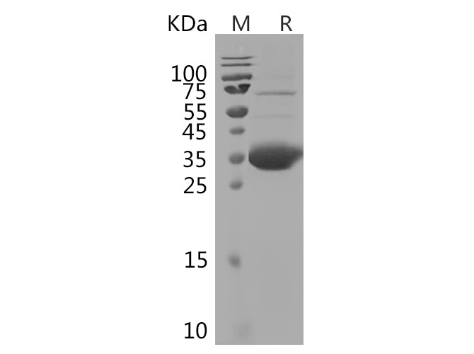 SDS-PAGE analysis of Rabbit IL21 proteins, 2 μg/lane of Recombinant Rabbit IL21 proteins was resolved with SDS-PAGE under reducing conditions, showing bands at 40-45 kDa.
