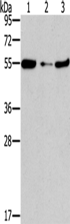 Anti-Human/Mouse FGFR1OP Antibody - ABMIUM