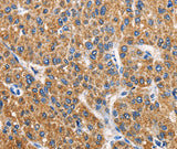 Anti-Human/Mouse/Rat APLNR Antibody - ABMIUM