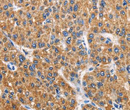 Anti-Human/Mouse/Rat APLNR Antibody