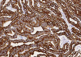 Anti-Human KRT19 Antibody [A1011] - ABMIUM