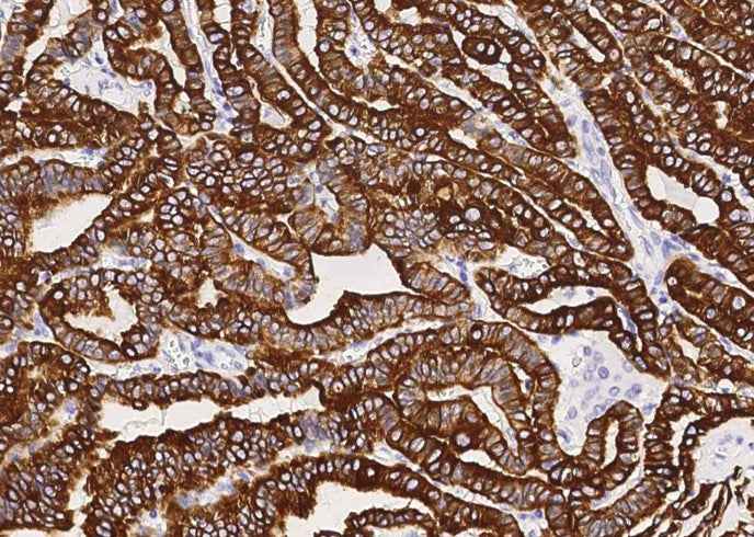 Anti-Human KRT19 Antibody [A1011] - ABMIUM