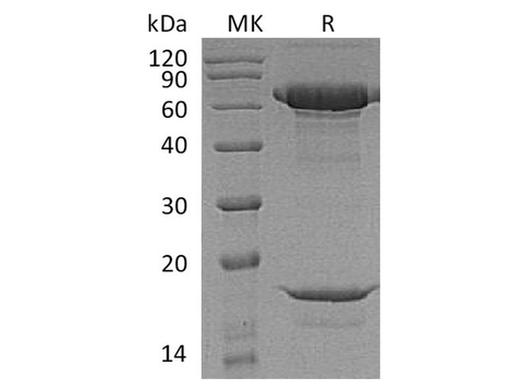 Recombinant Macaca nemestrina PCSK9/Proprotein Convertase 9 Protein (His Tag) - ABMIUM