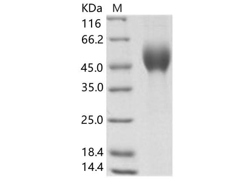 Recombinant EBOV (subtype Zaire, strain H.sapiens-wt/GIN/2014/Kissidougou-C15) Glycoprotein / GP-RBD Protein (His Tag) - ABMIUM