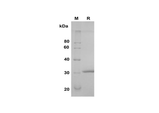 SDS-PAGE analysis of Human Try-2 proteins, 2 μg/lane of Recombinant Human Try-2 proteins was resolved with SDS-PAGE under reducing conditions, showing bands at 30 kDa.
