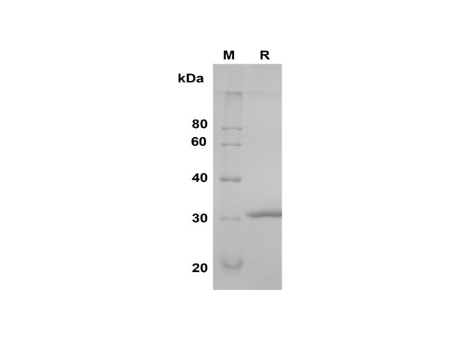 SDS-PAGE analysis of Human Try-2 proteins, 2 μg/lane of Recombinant Human Try-2 proteins was resolved with SDS-PAGE under reducing conditions, showing bands at 30 kDa.