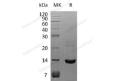Recombinant Human S100A8 Protein (His Tag) - ABMIUM