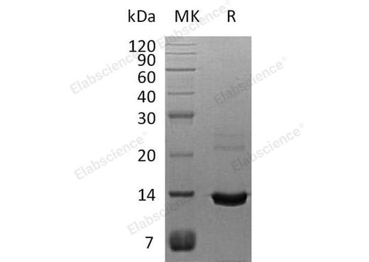 Recombinant Human S100A8 Protein (His Tag) - ABMIUM