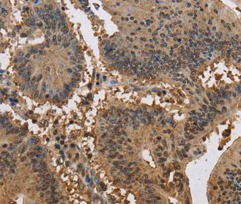 Anti-Human JAG2 Antibody