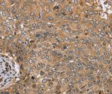 Anti-Human CLEC16A Antibody - ABMIUM