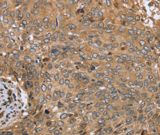 Anti-Human CLEC16A Antibody - ABMIUM