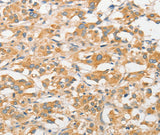 Anti-Human TLR5 Antibody - ABMIUM