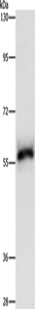 Anti-Human/Mouse/Rat HCK Antibody - ABMIUM