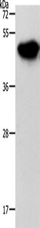 Anti-Human/Mouse/Rat NDRG3 Antibody - ABMIUM