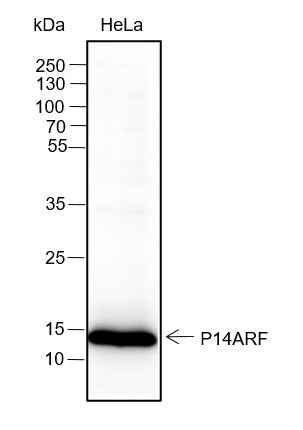 Anti-Human CDKN2A/p14ARF Antibody [A318] - ABMIUM