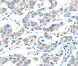 Anti-Human XBP1 Antibody - ABMIUM