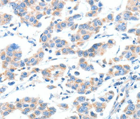 Anti-Human XBP1 Antibody - ABMIUM