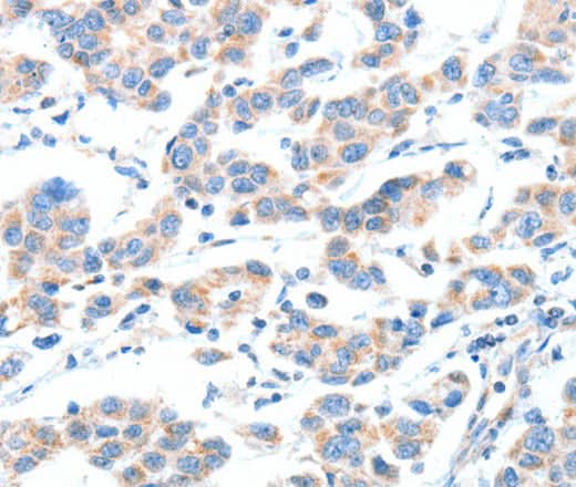 Anti-Human XBP1 Antibody - ABMIUM